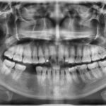 Finding a Panoramic X-Ray Near You: A Complete Guide to Dental Imaging
